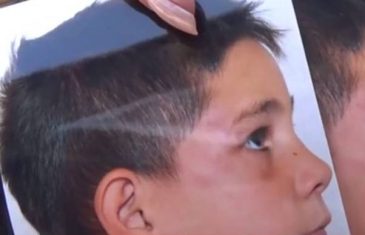 Ljekari davili i šamarali sedmogodišnjeg dječaka iz Makedonije