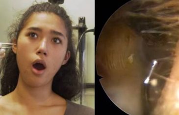 LIČILO JE NA KORNFLEKS: Doktor joj je u uvo gurnuo instrument sa kamerom. Kad su videli šta joj je u glavi – POZLILO IM JE (VIDEO)