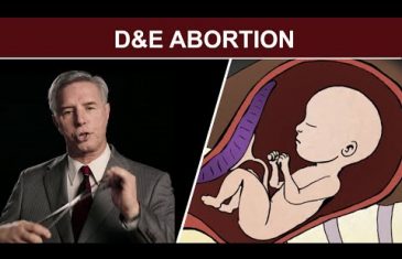 GROZNA ISTINA Pogledajte šta se sve dešava s bebom tokom abortusa (VIDEO)
