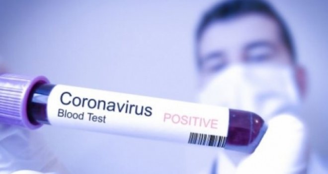 KAŠLJALA JE I IMALA BOLOVE U GRLU: Žena pozitivna na koronavirus zarazila 15 putnika u…