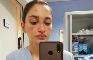Medicinska sestra iz Italije objavila selfie s posla, pogledajte joj lice!