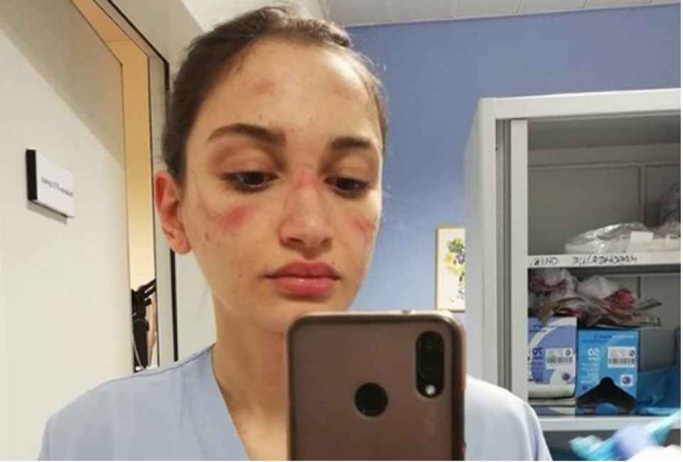 Medicinska sestra iz Italije objavila selfie s posla, pogledajte joj lice!